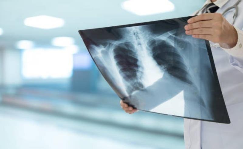 Dor sem imagem: quando os exames não mostram, mas a dor existe